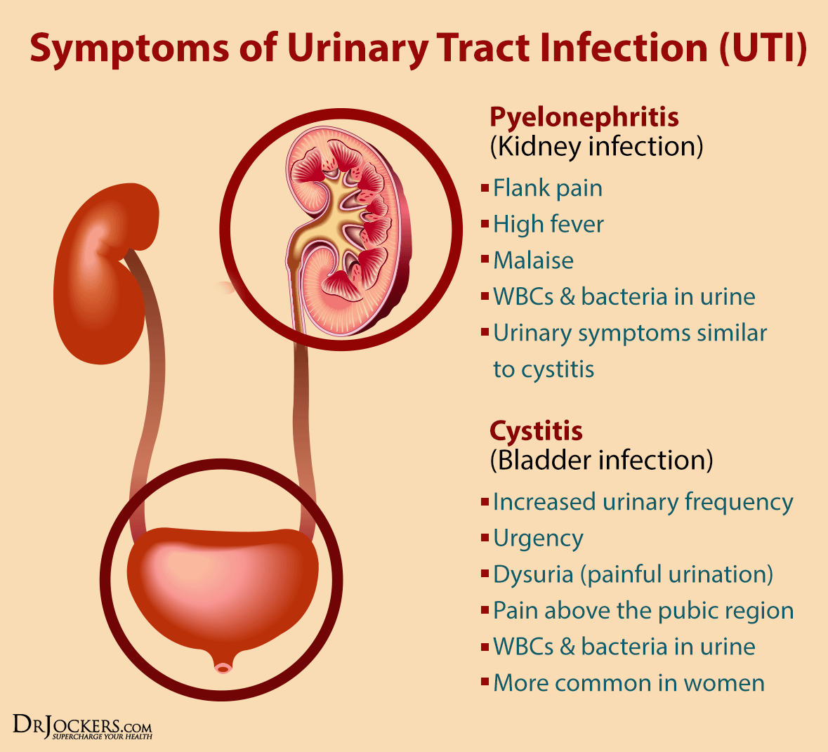 bladder infections or urinary tract infection