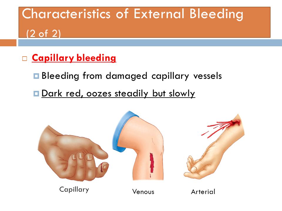 bleeding