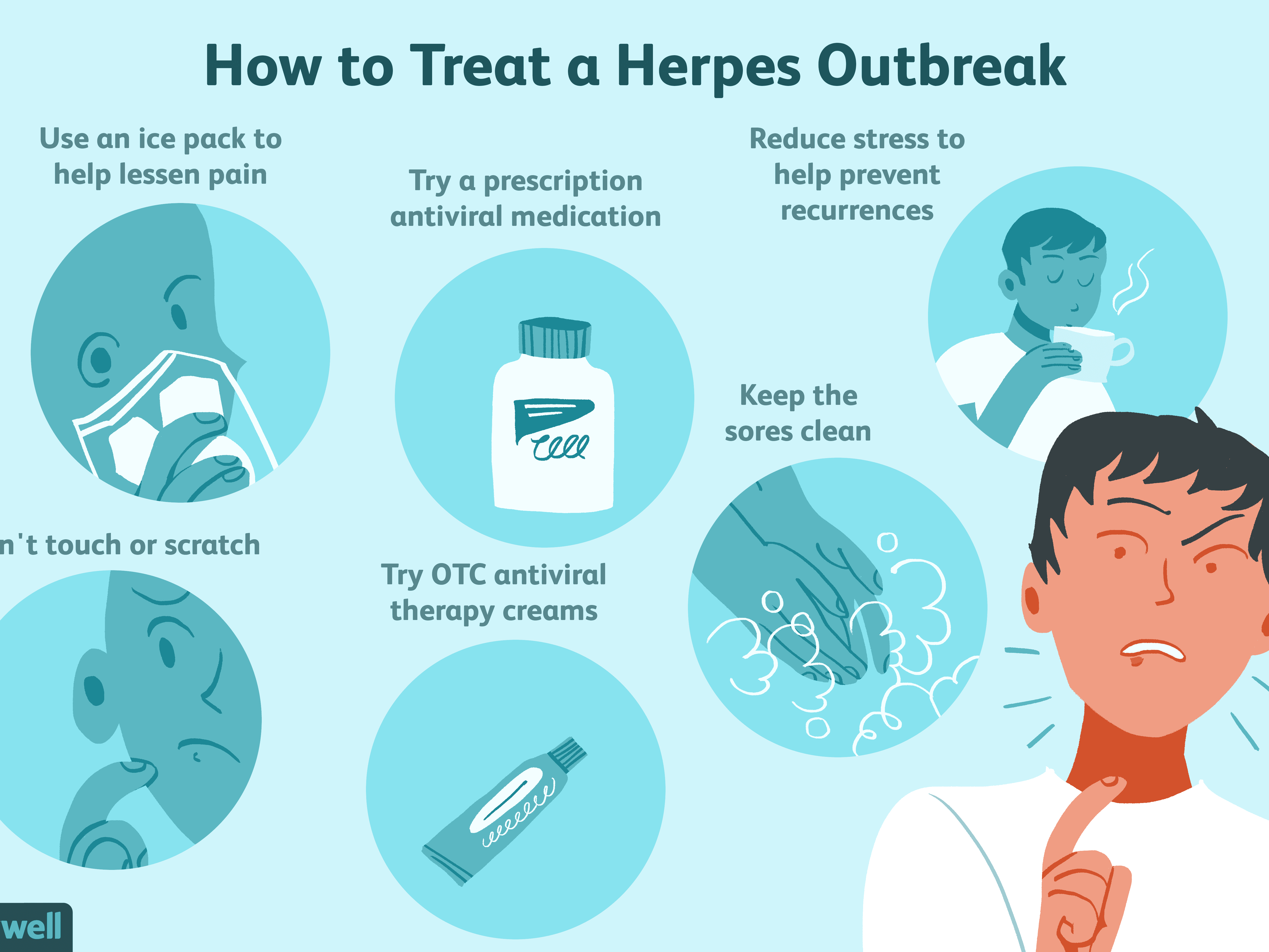 herpes outbreak