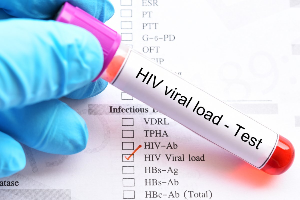 hiv viral load